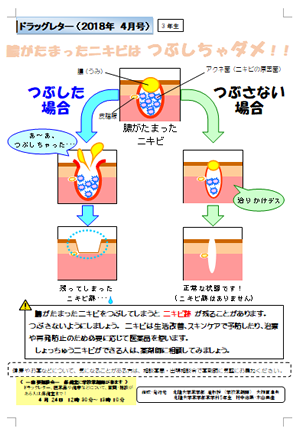 2018年4月（3年生）膿がたまったニキビはつぶしちゃダメ！！